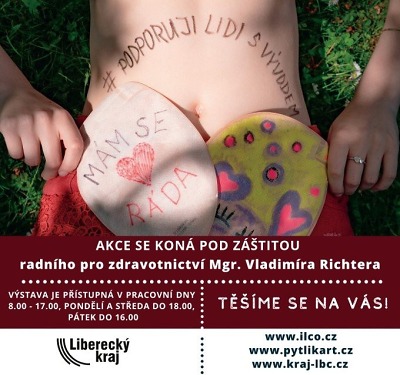 Autor foto:Archiv KÚ Libereckého kraje České ILCO boří mýty o stomii. Organizuje putovní výstavu PytlíkART